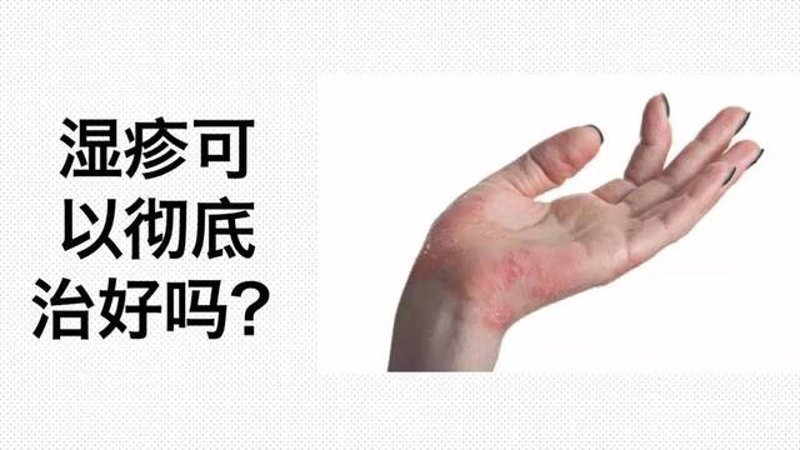 探索保定皮肤病医院的最新动态