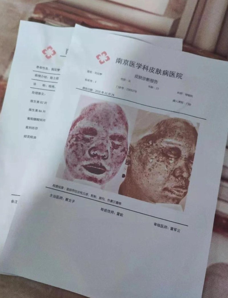 湿疹治疗新进展:寻找皮肤健康的秘密武器